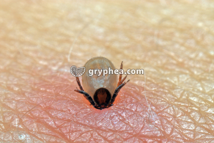 Tique en cours d'alimentation sur la peau (Ixodes sp.) - gryphea.org